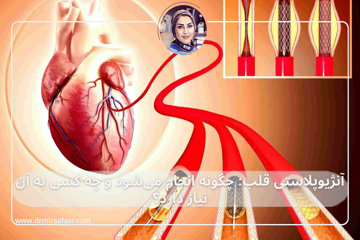 آنژیوپلاستی قلب چگونه انجام میشود و چه کسی به آن نیاز دارد؟