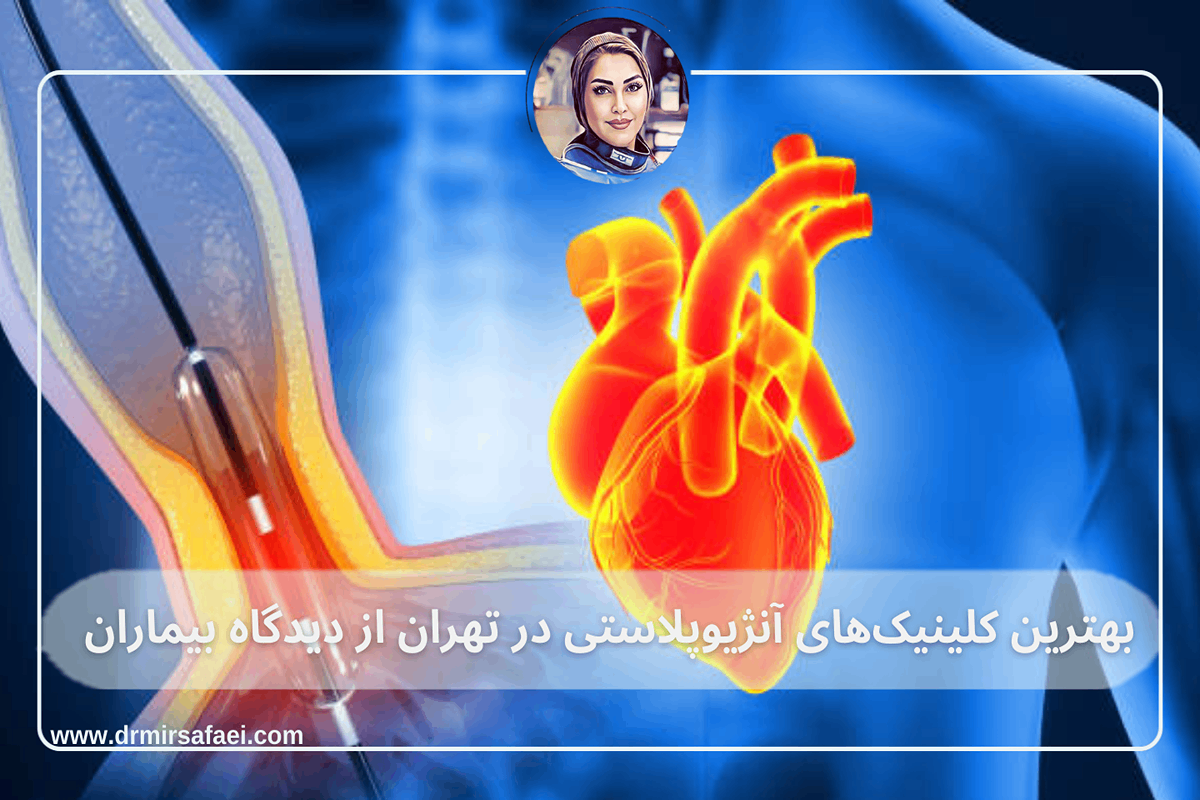 آنژیوپلاستی در تهران