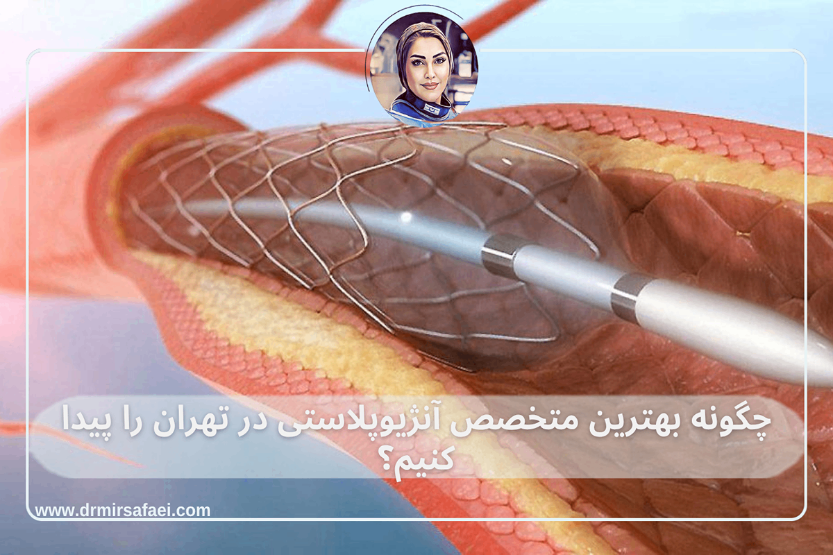 چگونه بهترین متخصص آنژیوپلاستی در تهران را پیدا کنیم؟