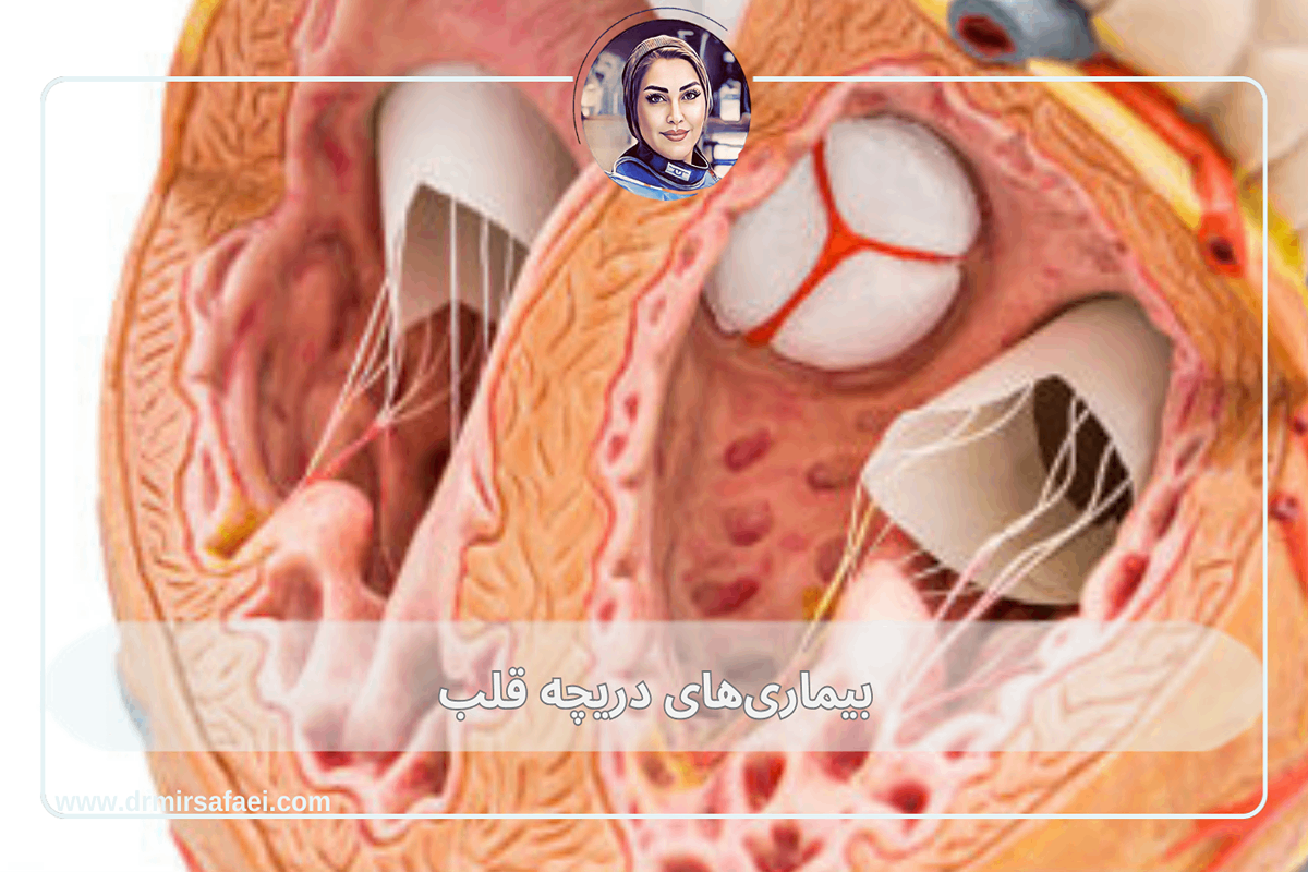 بیماری‌های دریچه قلب